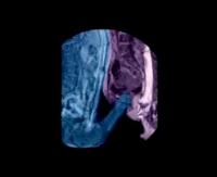 Sexuálny styk - magnetická rezonancia