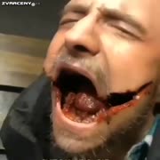 Rozseklá držka