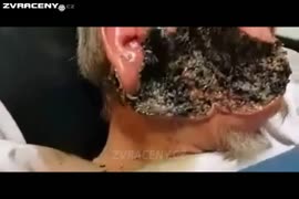 Hnijící tvář